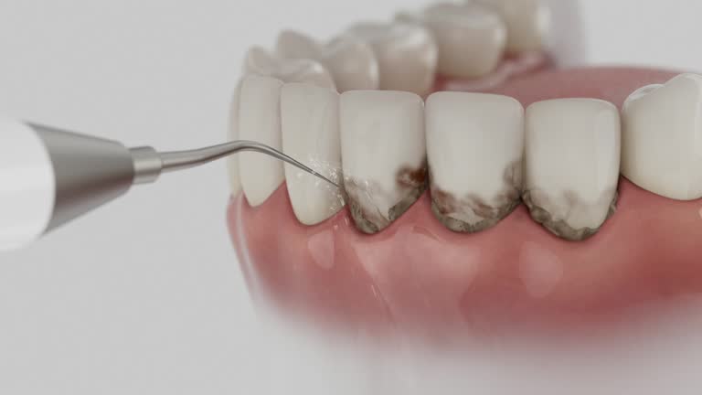 Trusted Root Canal Treatment service in Stallings, NC - Dentist Open Now